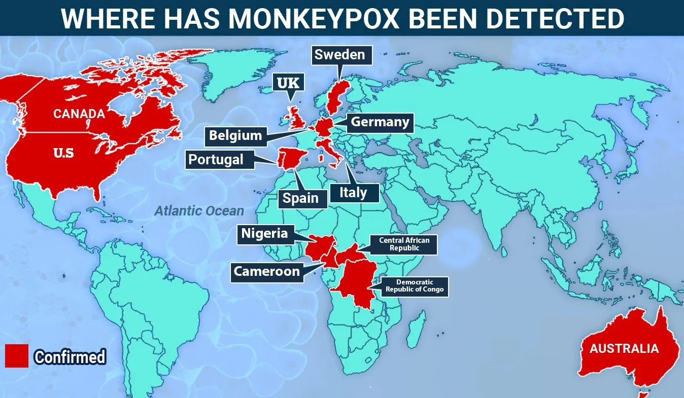 monkeypox virus mappa jpg